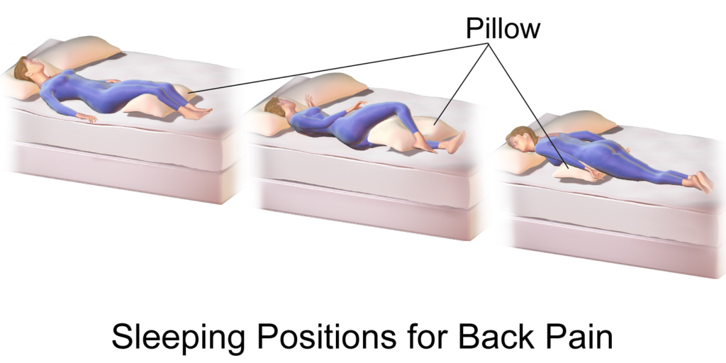 Best Sleeping Position for Lower Back Pain Relief